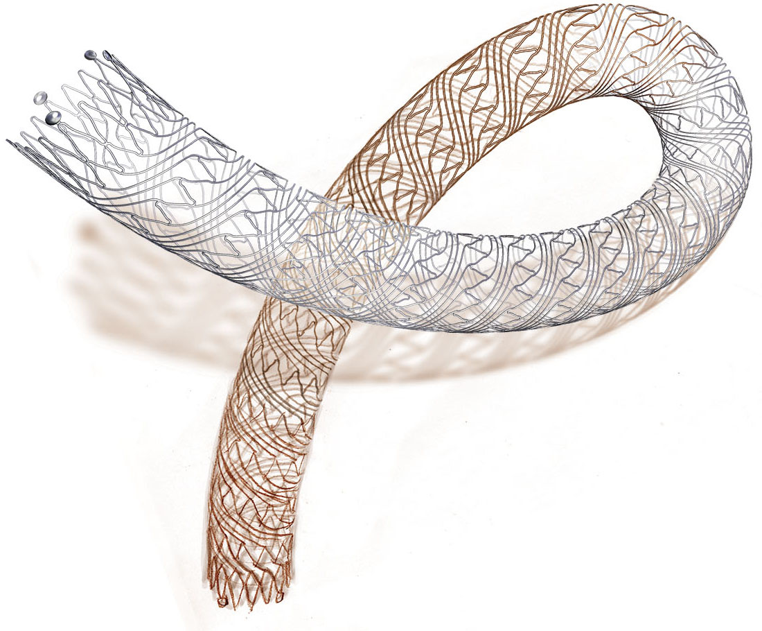 Cordis > cardiology cathlab > S.M.A.R.T® Flex vascular stent system