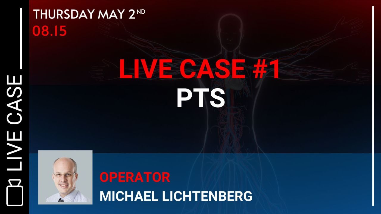 <b>Live case #1: PTS </b>