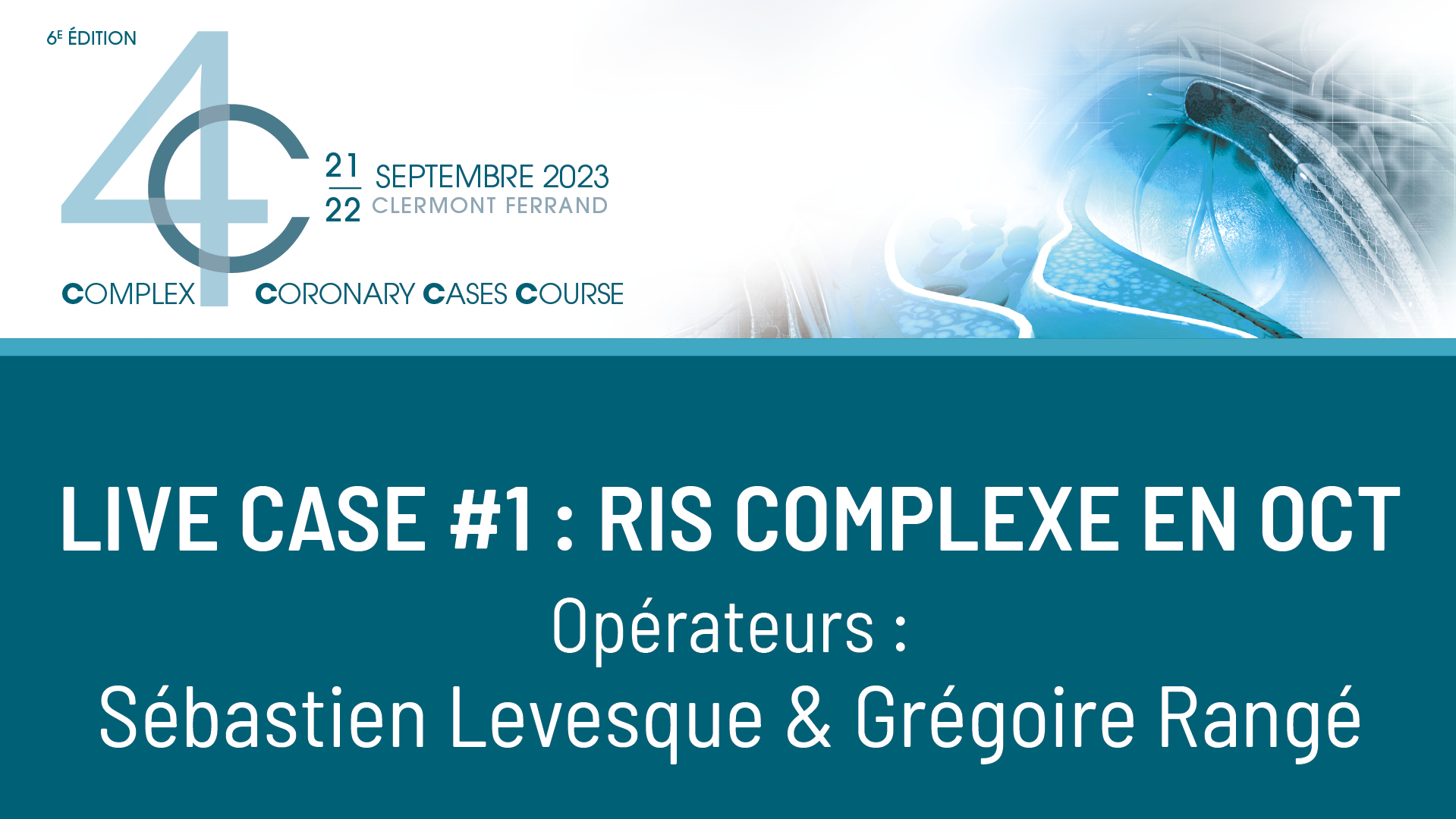 Live case #4 : Bifurcation en live sous OCT